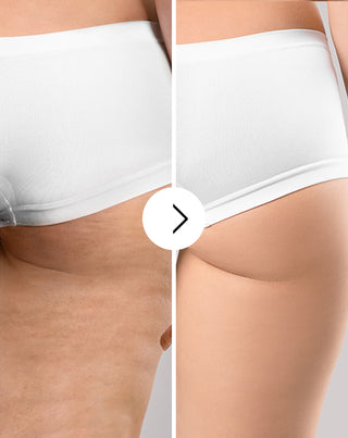 Tablety proti celulitíde a na zlepšenie pokožky s prírodnými výťažkami Cellinea 60 kapsúl_3 - 3