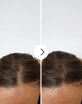 Kapsule proti vypadávaniu vlasov so zahusťujúcim a posilňujúcim účinkom Follixin 60 kapsúl_4 - 4