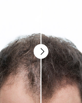 Kapsule proti vypadávaniu vlasov so zahusťujúcim a posilňujúcim účinkom Follixin 60 kapsúl_2 - 2