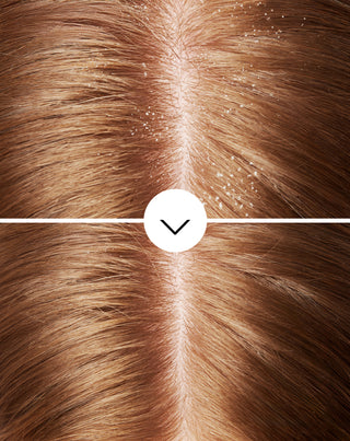 Šampón proti lupinám s pyroktón olamínom a s hydratačným účinkom Nutridome - 5