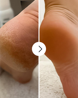 Nutridome zvláčňujúci krém na nohy s ureou a bambuckým maslom - 4