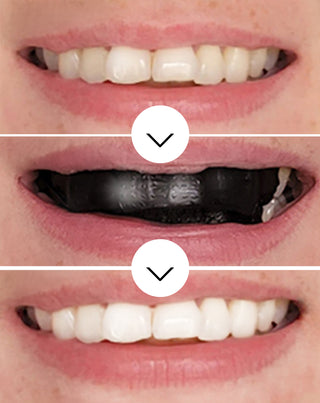 Bieliace pásiky na zuby The White(ning) Stripes Smilebite sada 28 ks - 3