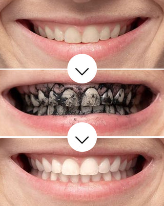 Bieliaci prášok na zuby Smilebite s kokosovým uhlím - 3
